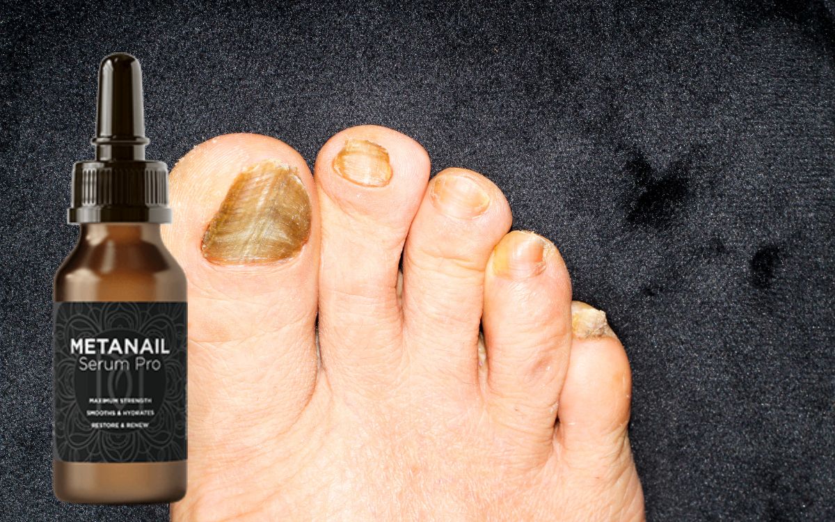 Metanail Serum Pro: Scam?
